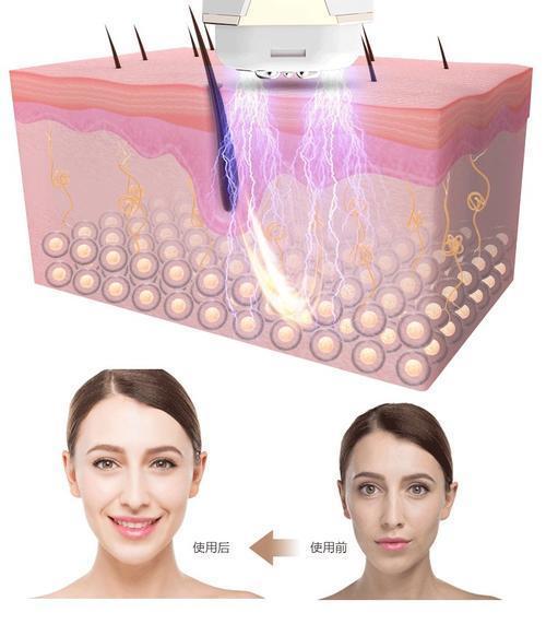 李佳琦自用美容仪走红 曾因价低被忽视，黄圣依坚持使用两年
